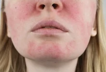 راهنمای جامع جوانسازی و رفع علائم پیری پوست صورت + آموزش تمرینات
