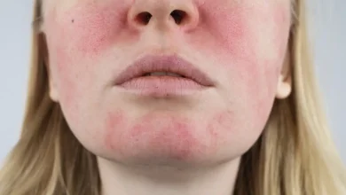 راهنمای جامع جوانسازی و رفع علائم پیری پوست صورت + آموزش تمرینات