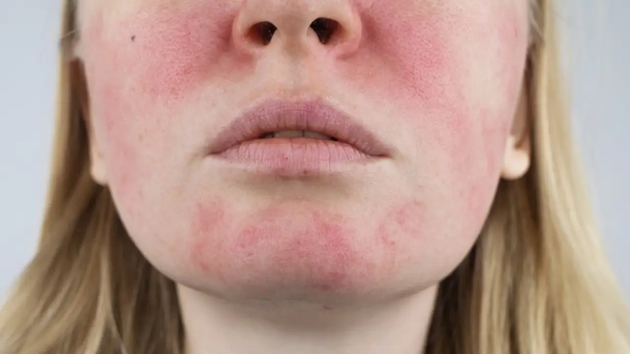 راهنمای جامع جوانسازی و رفع علائم پیری پوست صورت + آموزش تمرینات