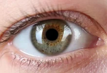 آشنایی شگفت‌انگیز در پزشکی احیای بینایی با تزریق طلا به چشم انسان 1